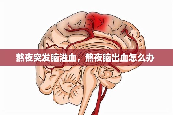 熬夜突发脑溢血，熬夜脑出血怎么办 